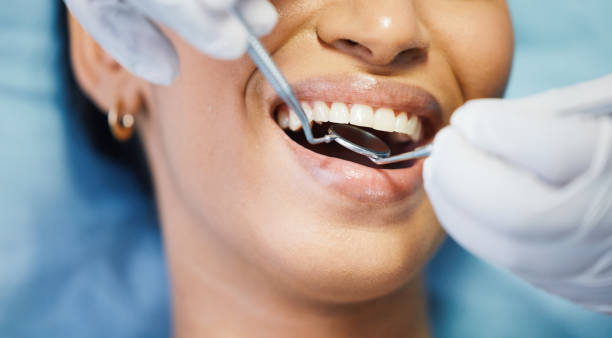 Best Emergency Care for Gum Disease in Bertsch Oceanview, CA